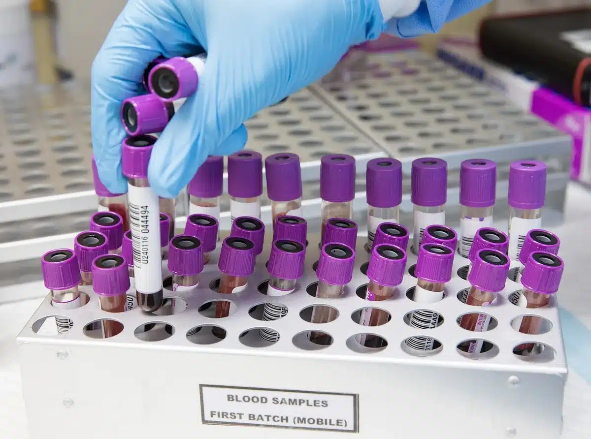 Close-up of an unbranded rapid diagnostic cartridge next to lab notes on a bench, no logos or identifiable people